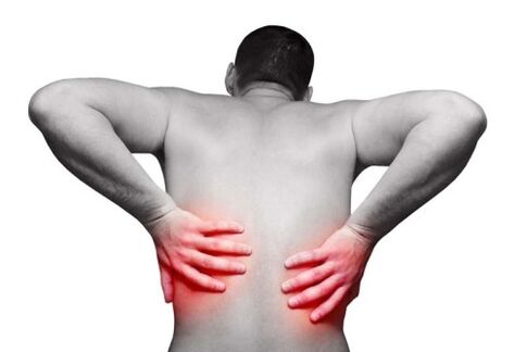 Dolor de espalda con osteocondrosis espinal. 