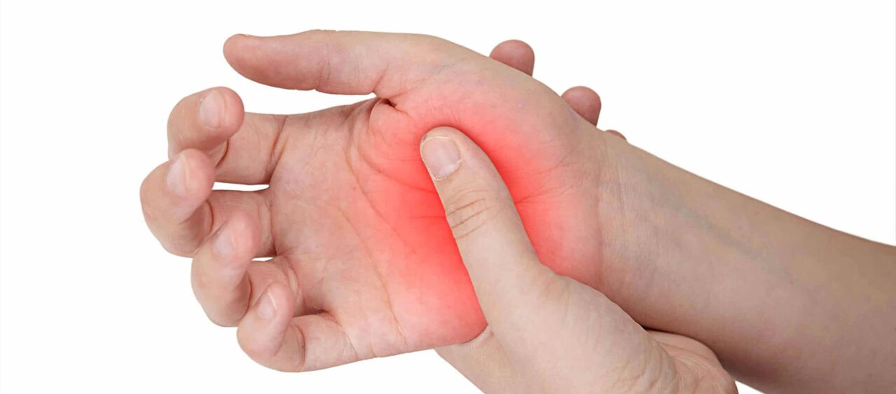 Dolor y enrojecimiento en las zonas articulares que acompañan al desarrollo de artrosis. 