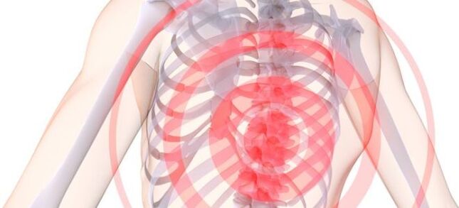 Posicionamiento del dolor de la condrosis mama