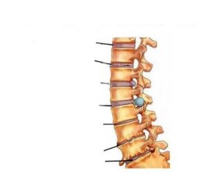 Síntomas de la osteocondrosis