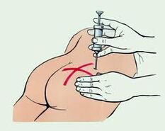 Inyecciones para tratar la osteocondrosis.