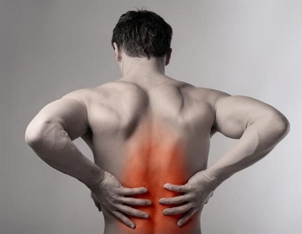 Dolor de espalda debido a osteocondrosis espinal.